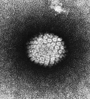 Electron micrograph of the human papilloma virus (HPV).